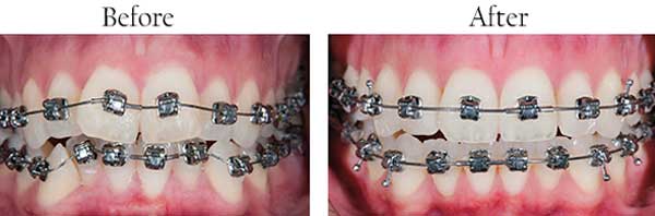 Mission Bend dental images