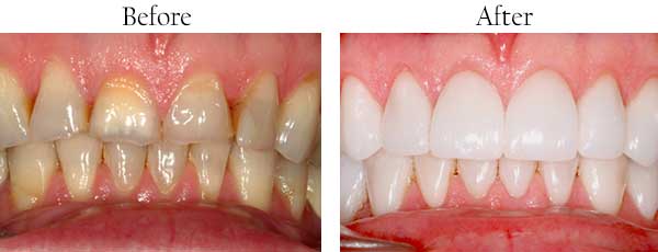 dental images 77498